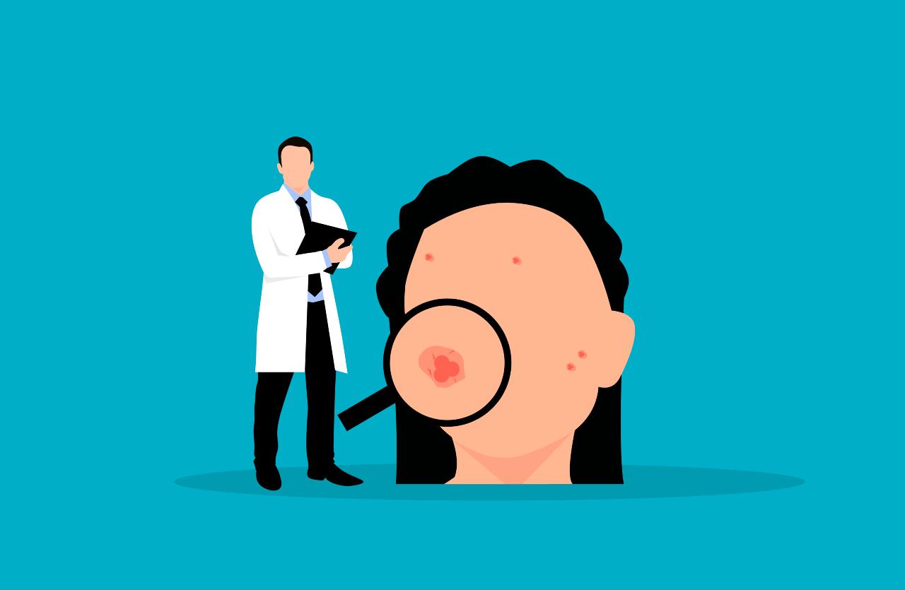 immagine disegno dermatologo e pelle con brufoli
