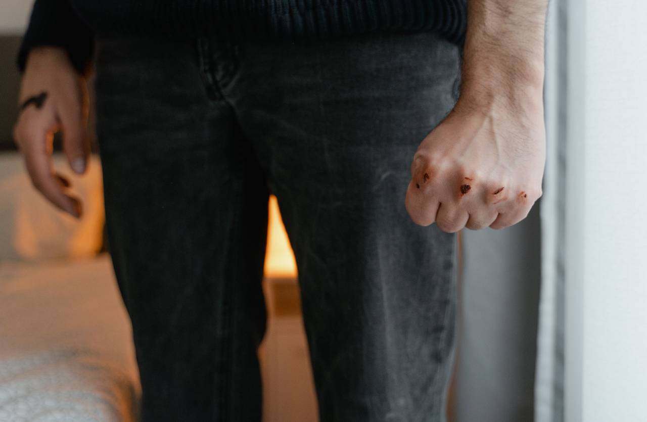 Dettaglio di un ragazzo con un pugno chiuso e nocche ferite 