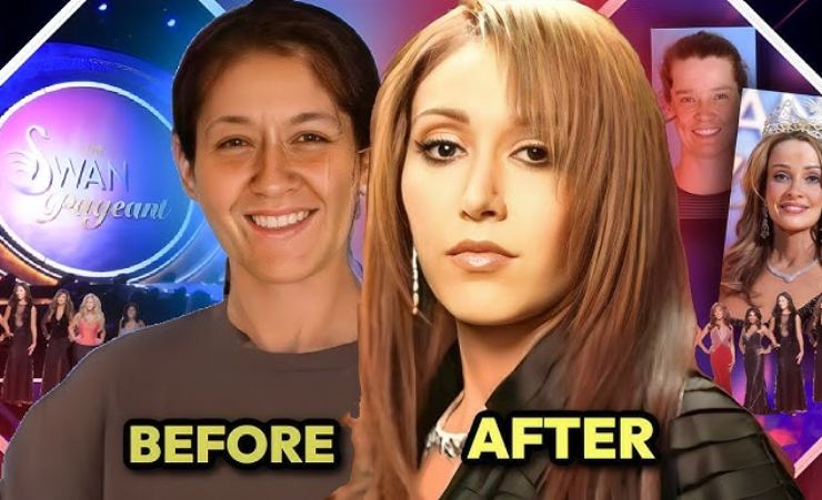 Un before e after a The Swan - LeBisbetiche.com